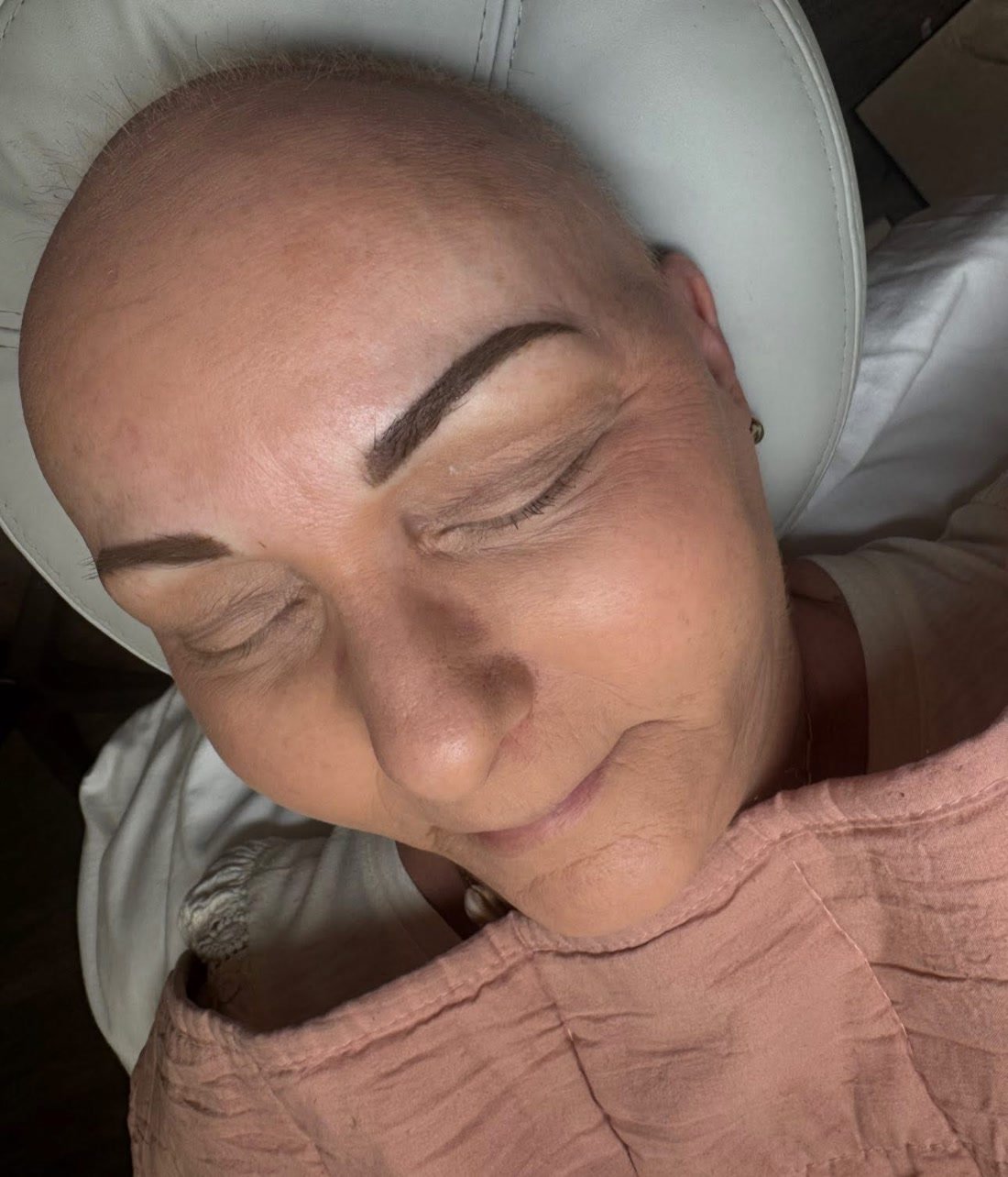 Healed permanent makeup brows on a client who has lost her hair, resting with her eyes closed.